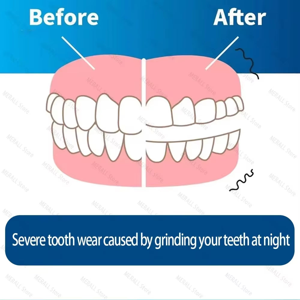 Anti Snoring Bruxism Mouth Guard Improve Sleep anti Teething Grinding Sleep Aid anti Snoring & Apnea Device