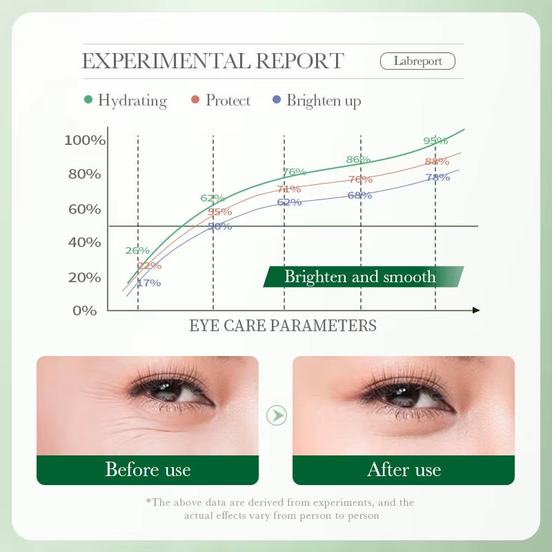 Centella Asiatica Eye Cream anti Dark Circles Eyes Bags Moisturizing anti Wrinkle Anti-Aging Beauty Eyes Skin Care Products