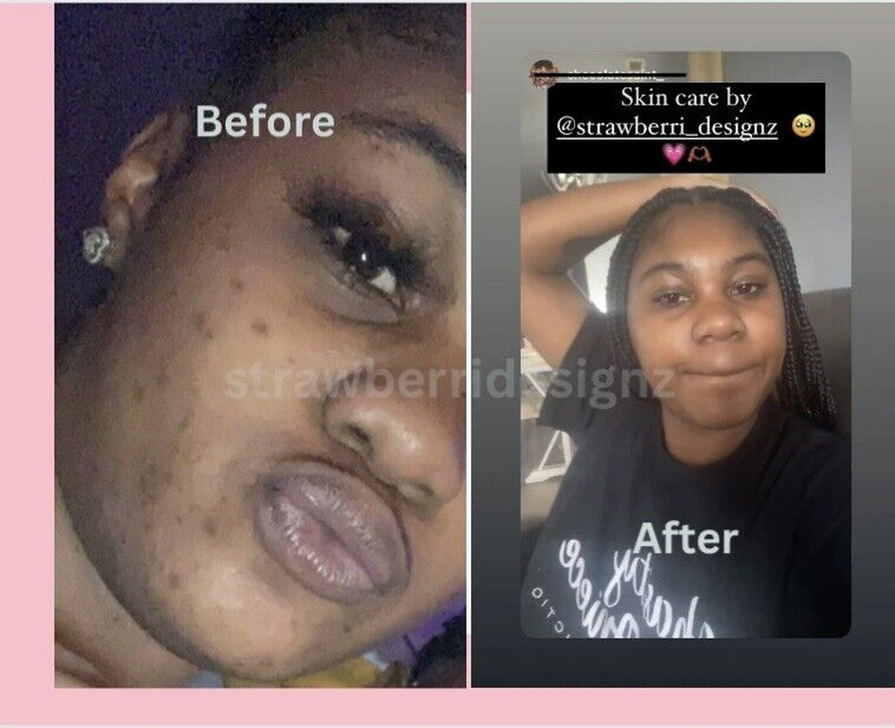 Turmeric & Honey, Dark Spots , Skin Glow, Brighter Skin, Scars,All Skin Type