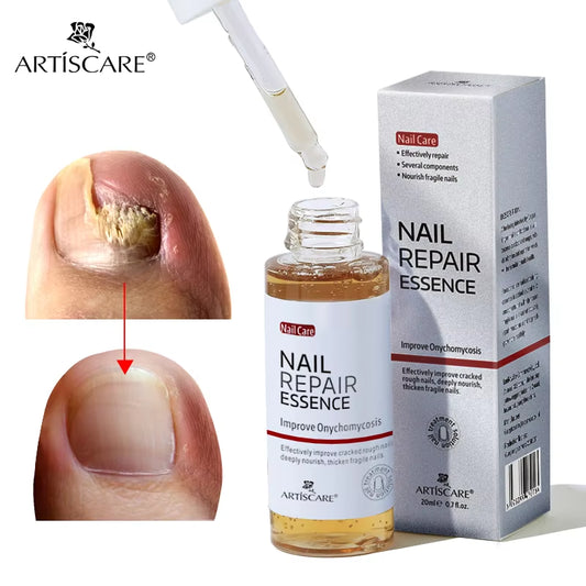 ARTISCARE Nail Care Essence Feet Care Nail Serum 20Ml