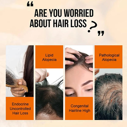 PURC High Hair Growth, Purc Oil for Hair Growth, HOVO Hair Density Essential Oil, Natural Hair Regrowth Serum, Anti-Frizz Hair Serum, Reduce Dry Hair Care Essential Oil for Women Men