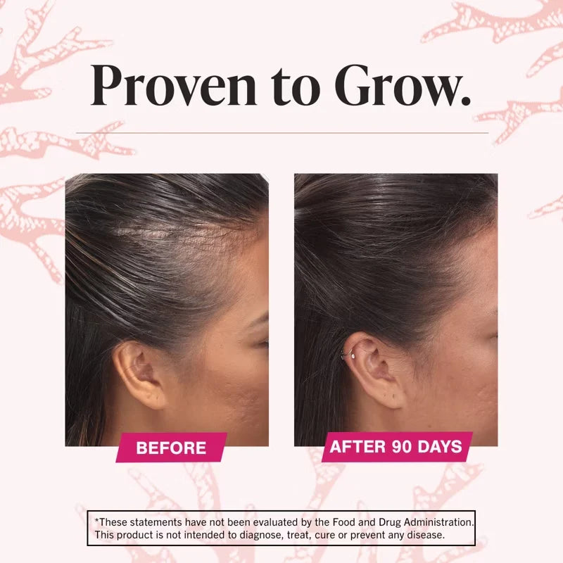 Hair Growth Supplements
