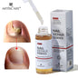 ARTISCARE Nail Care Essence Feet Care Nail Serum 20Ml